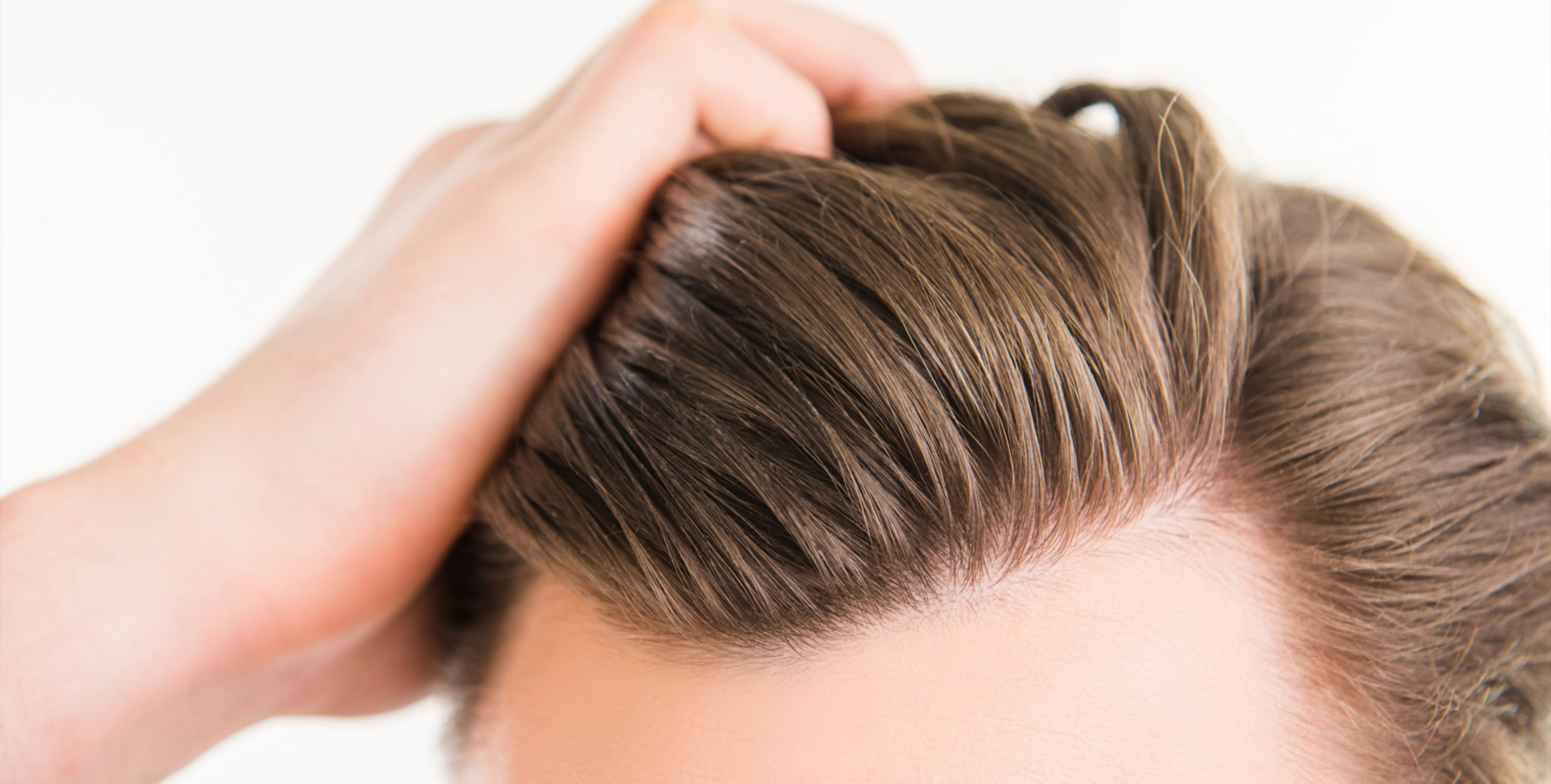receding hairline treatment options